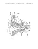 HEARING PROSTHESIS WITH AN IMPLANTABLE MICROPHONE SYSTEM diagram and image