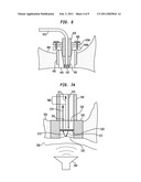 HEARING PROSTHESIS WITH AN IMPLANTABLE MICROPHONE SYSTEM diagram and image