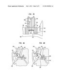 HEARING PROSTHESIS WITH AN IMPLANTABLE MICROPHONE SYSTEM diagram and image