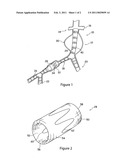 Prosthesis Coupling Device and Method diagram and image