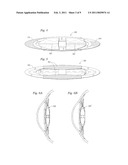 FIXATION OF OPHTHALMIC IMPLANTS diagram and image