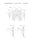 FIXATION OF OPHTHALMIC IMPLANTS diagram and image