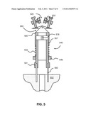 SURGICAL TENSIONING ASSEMBLY AND METHODS OF USE diagram and image