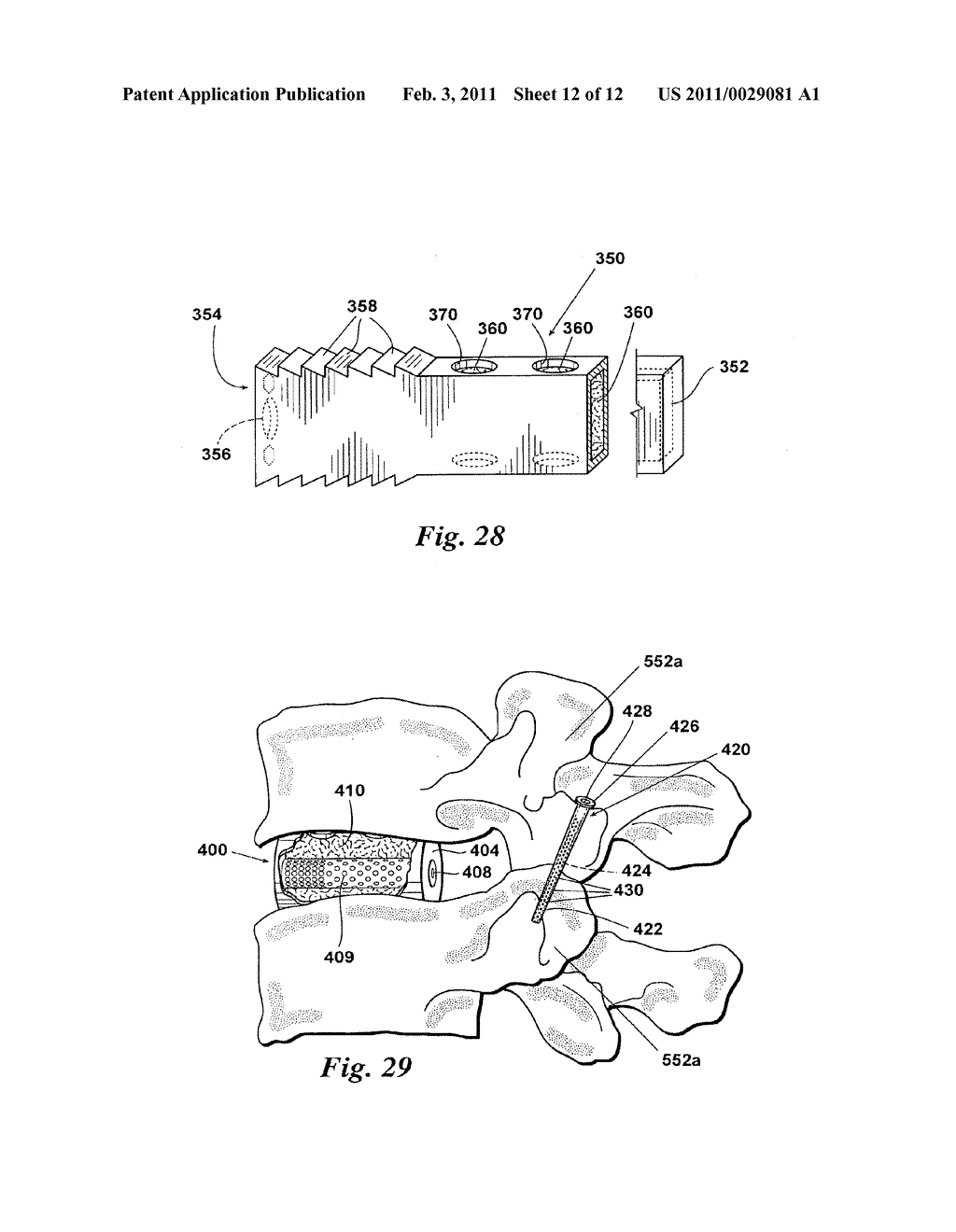 DEVICES AND METHODS FOR FACILITATING CONTROLLED BONE GROWTH OR REPAIR - diagram, schematic, and image 13