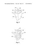 HIP PROSTHESIS diagram and image