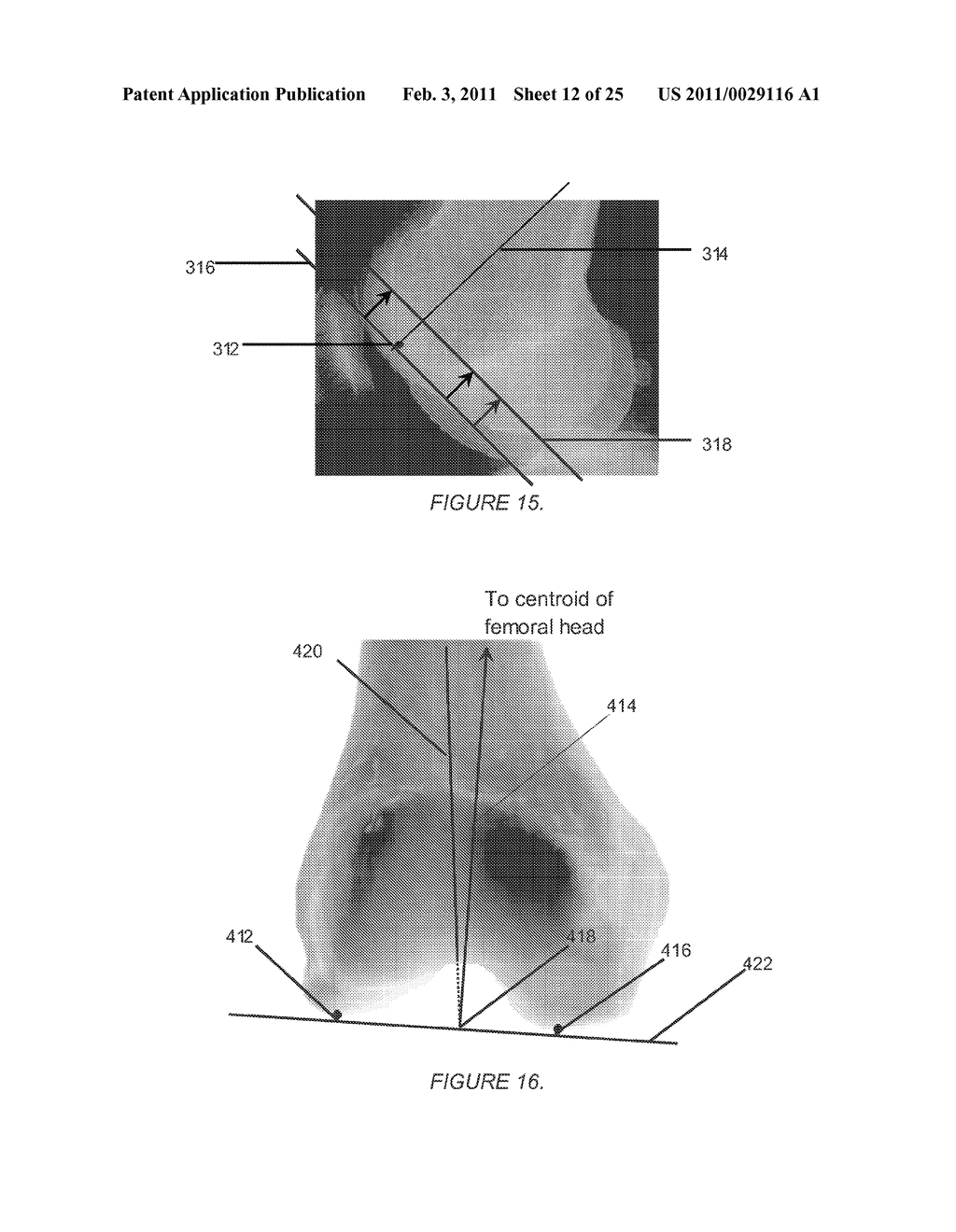 SYSTEMS AND METHODS FOR DETERMINING THE MECHANICAL AXIS OF A FEMUR - diagram, schematic, and image 13