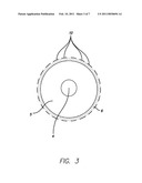 SYSTEM AND METHOD FOR IMAGING ENDOTRACHEAL TUBE PLACEMENT AND MEASURING AIRWAY OCCLUSION CUFF PRESSURE diagram and image