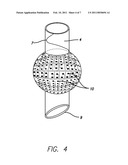 SYSTEM AND METHOD FOR IMAGING ENDOTRACHEAL TUBE PLACEMENT AND MEASURING AIRWAY OCCLUSION CUFF PRESSURE diagram and image