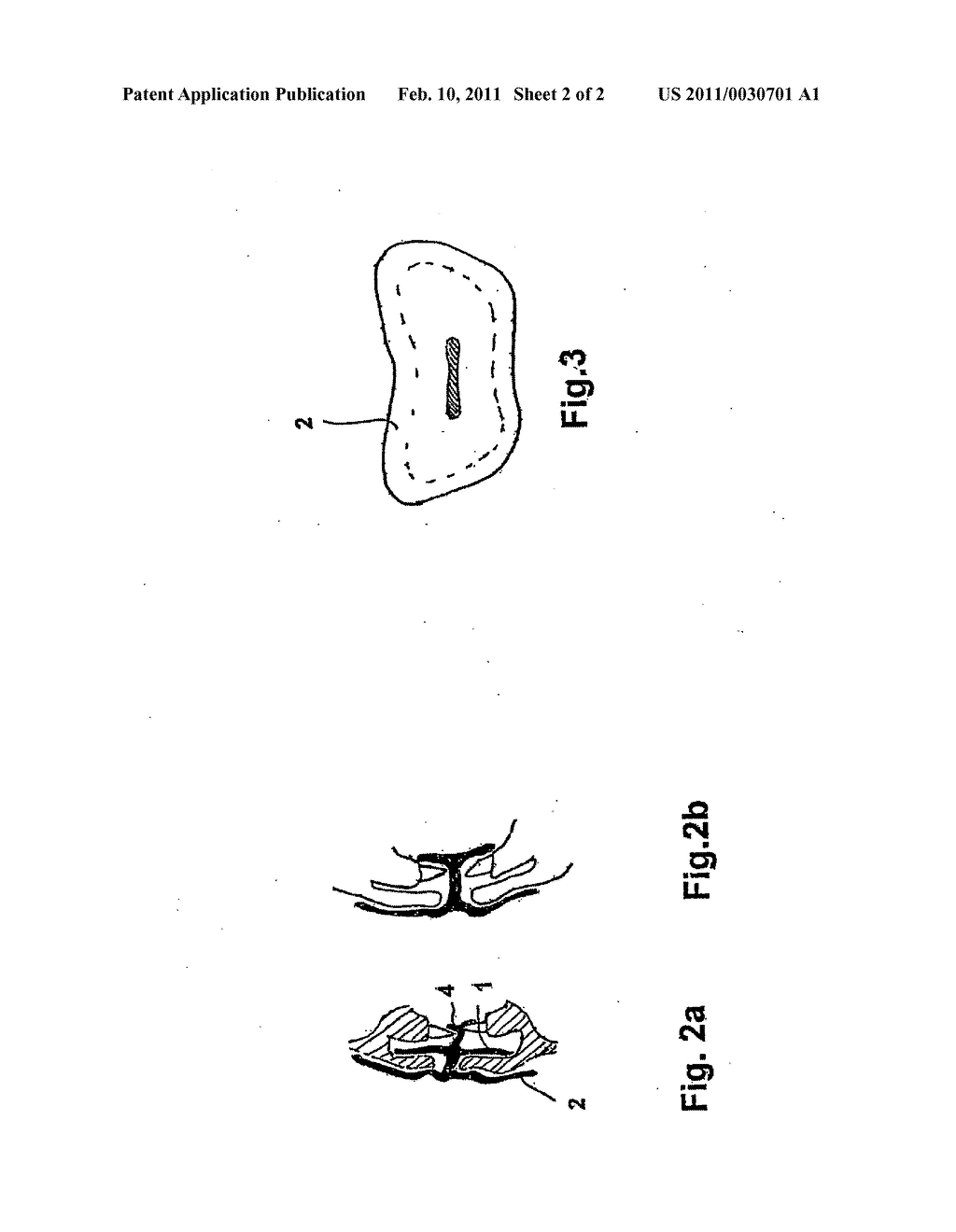 Device for preventing leakage from the mouth - diagram, schematic, and image 03