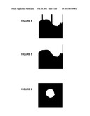 METHOD AND SYSTEM FOR STABILIZING A SERIES OF INTRAVASCULAR ULTRASOUND IMAGES AND EXTRACTING VESSEL LUMEN FROM THE IMAGES diagram and image