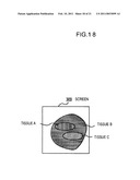 MEDICAL IMAGE PROCESSING DEVICE, METHOD FOR PROCESSING MEDICAL IMAGE AND PROGRAM diagram and image