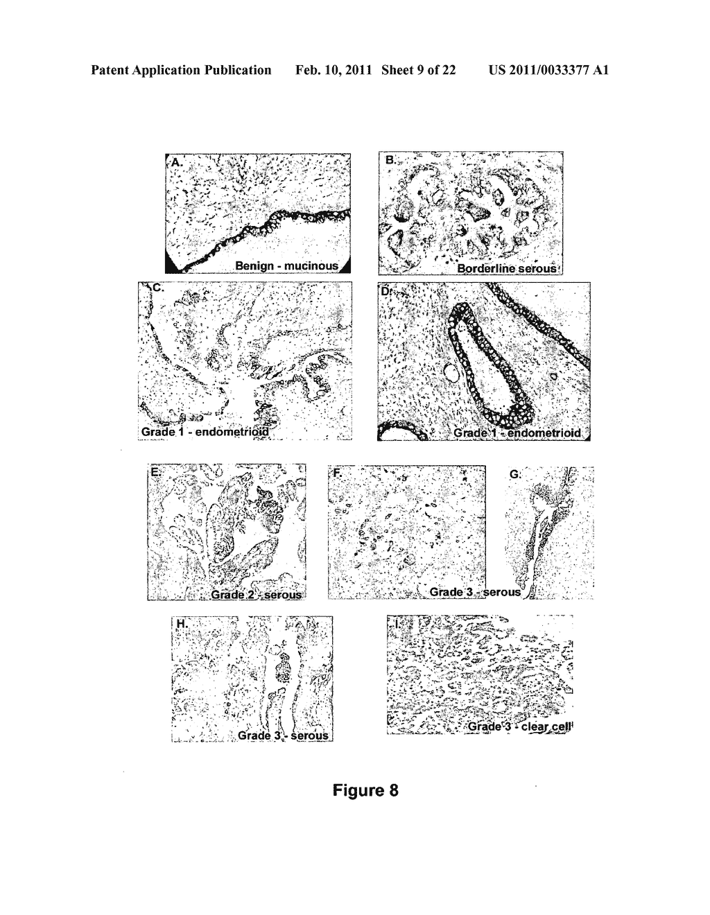 ASSAY TO DETECT A GYNECOLOGICAL CONDITION - diagram, schematic, and image 10