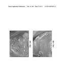 CULTURED THREE-DIMENSIONAL TISSUES AND USES THEREOF diagram and image