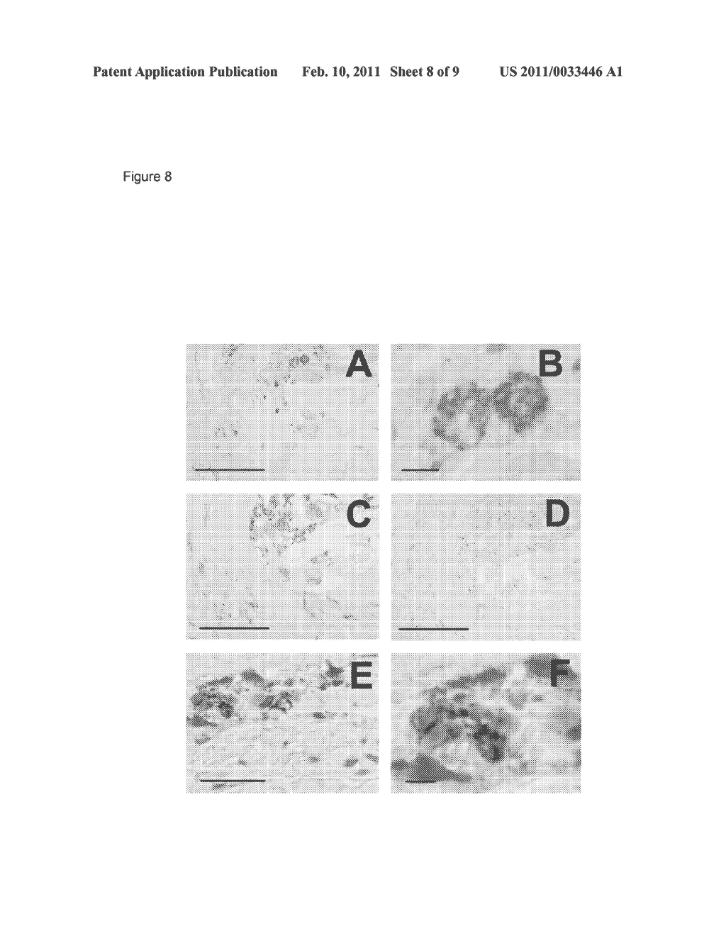 Treatment of HIV-1-infected individuals to reduce risk of coronary artery disease and suppress virus replication - diagram, schematic, and image 09