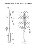 Endodontic File diagram and image