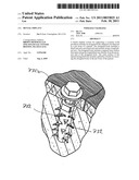 DENTAL IMPLANT diagram and image