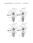 DENTAL IMPLANT diagram and image