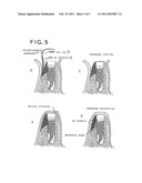 Method of using dental material and composite dental material formed by using hydroxyapatite diagram and image