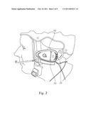 DEVICE FOR MOUNTING COMMUNICATION HEADSET TO SPORTS HELMETS AND THE LIKE diagram and image