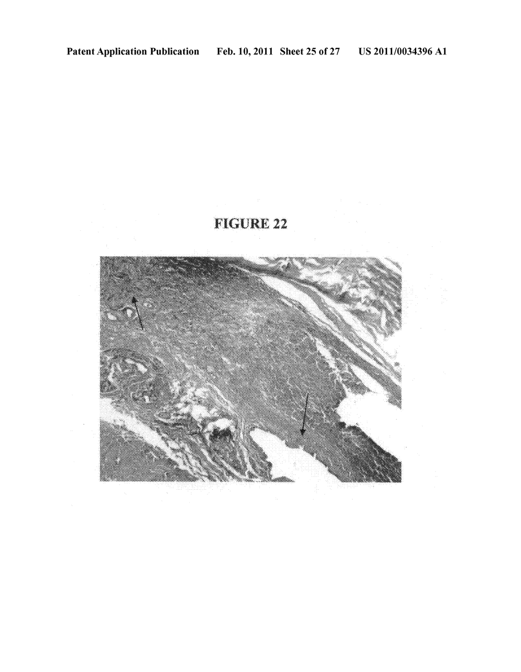 Methods and compositions for inhibiting cell migration and treatment of inflammatory conditions - diagram, schematic, and image 26