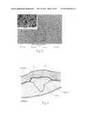 Wound dressing and method for controlling severe, life-threatening bleeding diagram and image