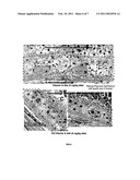 COMPOSITIONS AND METHODS FOR TREATING MACULAR DEGENERATION diagram and image