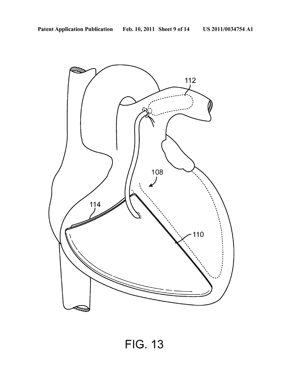 DEVICES AND METHODS FOR ABSORBING, TRANSFERRING AND DELIVERING HEART ENERGY - diagram, schematic, and image 10