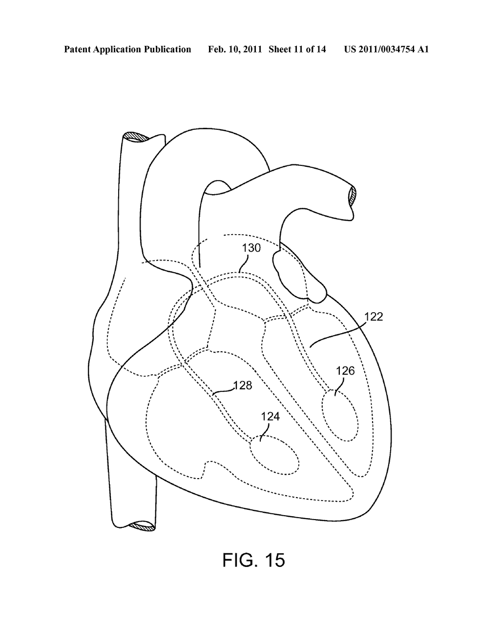 DEVICES AND METHODS FOR ABSORBING, TRANSFERRING AND DELIVERING HEART ENERGY - diagram, schematic, and image 12