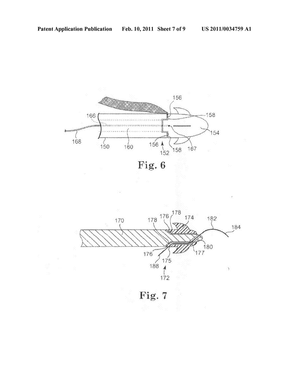 SURGICAL ARTICLES AND METHODS FOR TREATING PELVIC CONDITIONS - diagram, schematic, and image 08