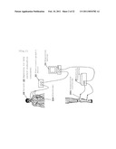 APPARATUS FOR BODY SURFACE STIMULATION TREATMENT, PROGRAM FOR BODY SURFACE STIMULATION TREATMENT, AND COMPUTER-READABLE RECORDING MEDIUM HAVING RECORDED THE SAME diagram and image