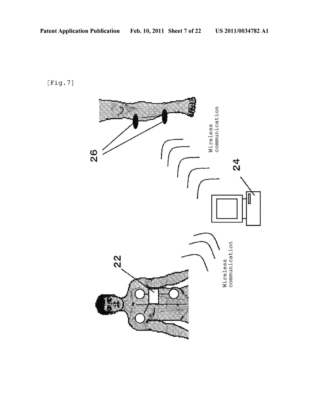 APPARATUS FOR BODY SURFACE STIMULATION TREATMENT, PROGRAM FOR BODY SURFACE STIMULATION TREATMENT, AND COMPUTER-READABLE RECORDING MEDIUM HAVING RECORDED THE SAME - diagram, schematic, and image 08