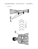 APPARATUS FOR BODY SURFACE STIMULATION TREATMENT, PROGRAM FOR BODY SURFACE STIMULATION TREATMENT, AND COMPUTER-READABLE RECORDING MEDIUM HAVING RECORDED THE SAME diagram and image