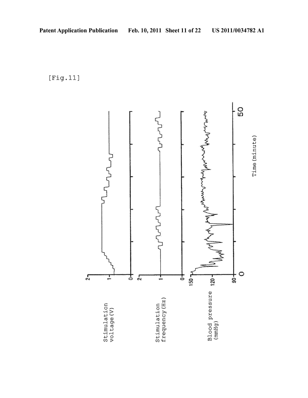 APPARATUS FOR BODY SURFACE STIMULATION TREATMENT, PROGRAM FOR BODY SURFACE STIMULATION TREATMENT, AND COMPUTER-READABLE RECORDING MEDIUM HAVING RECORDED THE SAME - diagram, schematic, and image 12