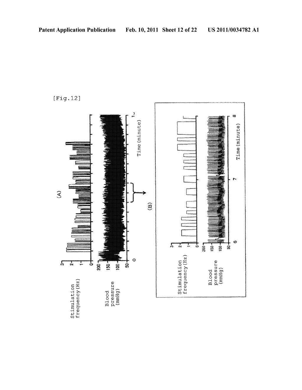 APPARATUS FOR BODY SURFACE STIMULATION TREATMENT, PROGRAM FOR BODY SURFACE STIMULATION TREATMENT, AND COMPUTER-READABLE RECORDING MEDIUM HAVING RECORDED THE SAME - diagram, schematic, and image 13