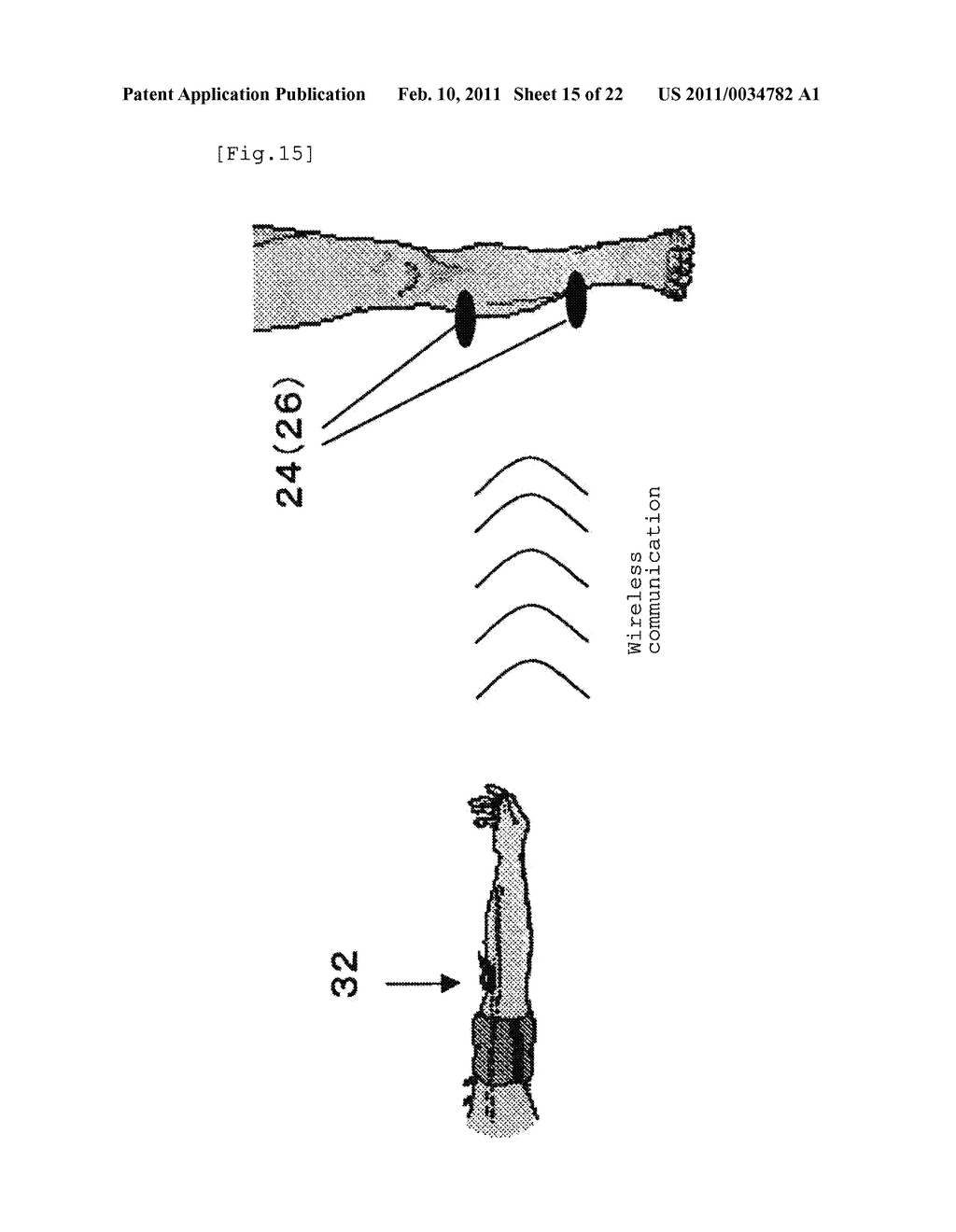 APPARATUS FOR BODY SURFACE STIMULATION TREATMENT, PROGRAM FOR BODY SURFACE STIMULATION TREATMENT, AND COMPUTER-READABLE RECORDING MEDIUM HAVING RECORDED THE SAME - diagram, schematic, and image 16