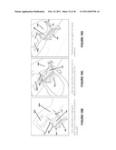 APPARATUS AND METHOD FOR SUBSTANTIALLY IMMOBILIZING A BREAST FOR MEDICAL IMAGING PROCEDURE diagram and image