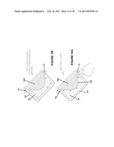 APPARATUS AND METHOD FOR SUBSTANTIALLY IMMOBILIZING A BREAST FOR MEDICAL IMAGING PROCEDURE diagram and image