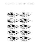 NON-INVASIVE MEASURING OF LOAD-INDUCED ELECTRIC POTENTIALS IN DIARTHROIDIAL JOINTS diagram and image