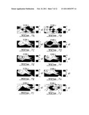 NON-INVASIVE MEASURING OF LOAD-INDUCED ELECTRIC POTENTIALS IN DIARTHROIDIAL JOINTS diagram and image