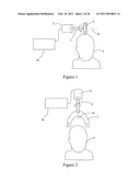 SYSTEMS AND METHODS FOR MODULATING THE ELECTRICAL ACTIVITY OF A BRAIN USING NEURO-EEG SYNCHRONIZATION THERAPY diagram and image