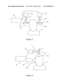 SYSTEMS AND METHODS FOR MODULATING THE ELECTRICAL ACTIVITY OF A BRAIN USING NEURO-EEG SYNCHRONIZATION THERAPY diagram and image