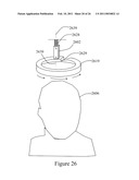 SYSTEMS AND METHODS FOR MODULATING THE ELECTRICAL ACTIVITY OF A BRAIN USING NEURO-EEG SYNCHRONIZATION THERAPY diagram and image