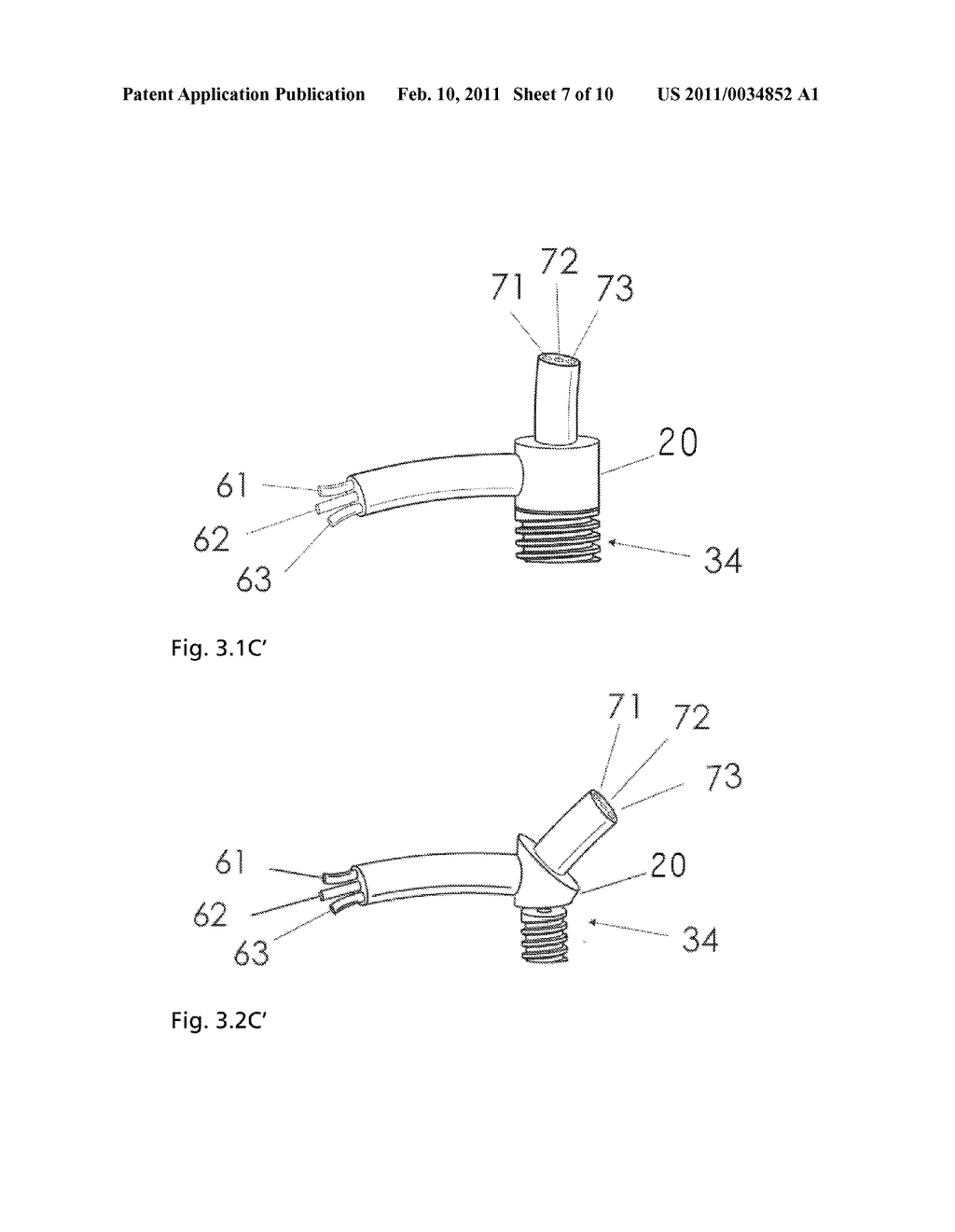 IMPLANTABLE ACCESS FOR REMOVAL AND/OR RETURN OF FLUIDS - diagram, schematic, and image 08