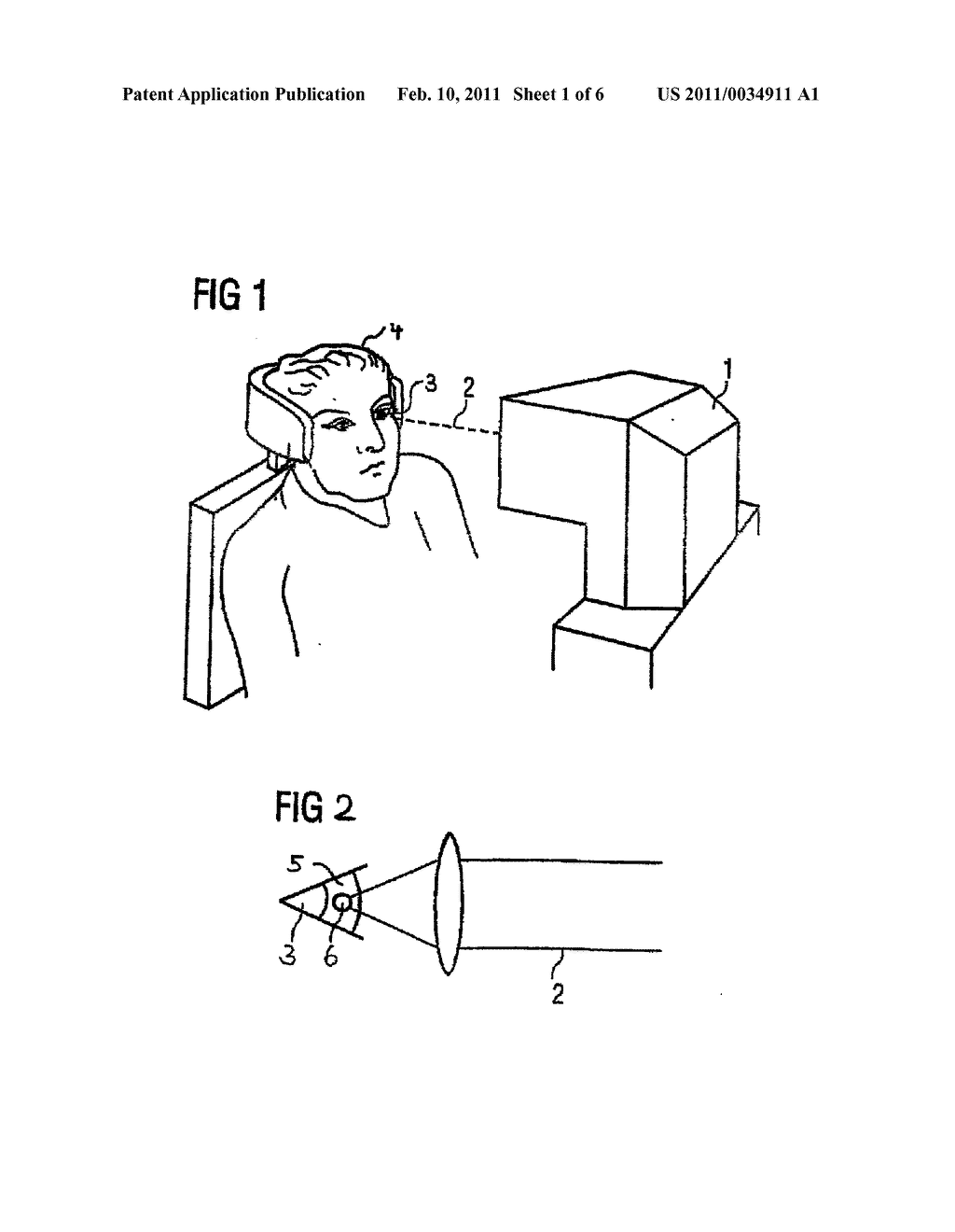 METHOD FOR GENERATING CONTROL DATA FOR EYE SURGERY, AND EYE-SURGICAL TREATMENT DEVICE AND METHOD - diagram, schematic, and image 02