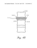 SYSTEMS,METHODS, AND DEVICES HAVING STRETCHABLE INTEGRATED CIRCUITRY FOR SENSING AND DELIVERING THERAPY diagram and image