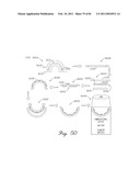 SYSTEMS,METHODS, AND DEVICES HAVING STRETCHABLE INTEGRATED CIRCUITRY FOR SENSING AND DELIVERING THERAPY diagram and image