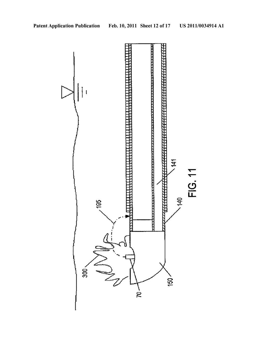 Devices for Electrosurgery - diagram, schematic, and image 13