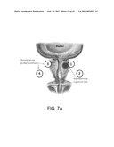 NANOPARTICLE-MEDIATED MICROWAVE TREATMENT METHODS diagram and image