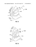 Blunt Tissue Dissection Surgical Instrument Jaw Designs diagram and image