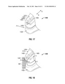 Blunt Tissue Dissection Surgical Instrument Jaw Designs diagram and image